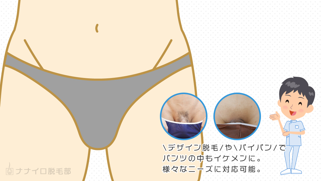 ゲイに人気のVIO脱毛(陰部脱毛・ちん毛脱毛)にも対応可能